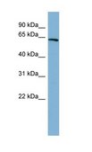 Anti-HNF1A, (N-terminal) antibody produced in rabbit affinity isolated antibody