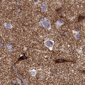Anti-NPTX1 Prestige Antibodies® Powered by Atlas Antibodies, affinity isolated antibody