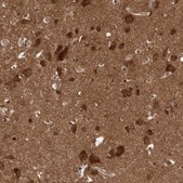 Anti-DIP2C antibody produced in rabbit Prestige Antibodies® Powered by Atlas Antibodies, affinity isolated antibody, buffered aqueous glycerol solution