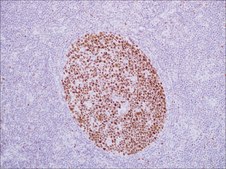 BCL6 (EP278) Rabbit Monoclonal Primary Antibody