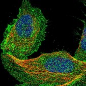 Anti-DCBLD2 antibody produced in rabbit Prestige Antibodies® Powered by Atlas Antibodies, affinity isolated antibody, buffered aqueous glycerol solution