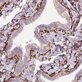 Monoclonal Anti-FBN1 antibody produced in mouse Prestige Antibodies® Powered by Atlas Antibodies, clone CL0225, purified immunoglobulin, buffered aqueous glycerol solution