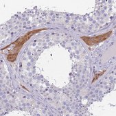 Anti-MAN1C1 antibody produced in rabbit Prestige Antibodies® Powered by Atlas Antibodies, affinity isolated antibody, buffered aqueous glycerol solution