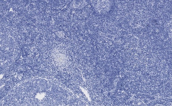 Anti-Ki67 Antibody, clone 1O15, ZooMAb&#174; Rabbit Monoclonal recombinant, expressed in HEK 293 cells