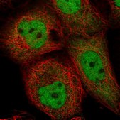 Anti-ING1 antibody produced in rabbit Prestige Antibodies® Powered by Atlas Antibodies, affinity isolated antibody