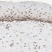 Anti-NR5A2 antibody produced in rabbit Ab1, Prestige Antibodies® Powered by Atlas Antibodies, affinity isolated antibody, buffered aqueous glycerol solution