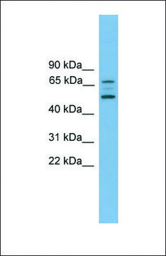 Anti-ACVR2B antibody produced in rabbit affinity isolated antibody