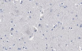 Anti-Akt Antibody, PH Domain Antibody, clone SKB1 ZooMAb® Mouse Monoclonal recombinant, expressed in HEK 293 cells