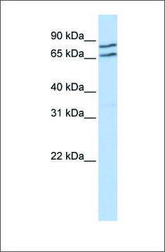 Anti-TFE3 antibody produced in rabbit affinity isolated antibody