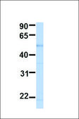 Anti-BCKDHA, (N-terminal) antibody produced in rabbit affinity isolated antibody