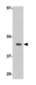 Anti-WNT10A Antibody from rabbit, purified by affinity chromatography