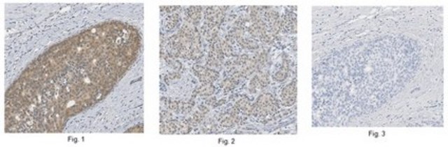 Anti-MLL2 (C-Term) Antibody from rabbit, purified by affinity chromatography