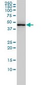 Monoclonal Anti-TARDBP antibody produced in mouse clone 2E2-D3, purified immunoglobulin, buffered aqueous solution