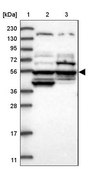 Anti-POC5 antibody produced in rabbit Prestige Antibodies® Powered by Atlas Antibodies, affinity isolated antibody, buffered aqueous glycerol solution