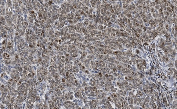 Anti-phospho-Smad2 (Ser465/467) Antibody, clone A5S, ZooMAb&#174; Rabbit Monoclonal recombinant, expressed in HEK 293 cells