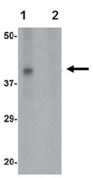 Anti-RNASET2 Antibody from rabbit, purified by affinity chromatography