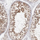 Anti-WDR77 antibody produced in rabbit Prestige Antibodies® Powered by Atlas Antibodies, affinity isolated antibody, buffered aqueous glycerol solution, ab2