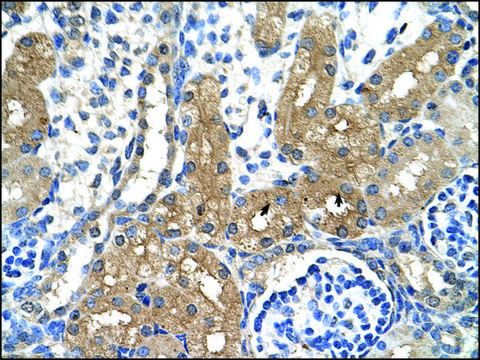 Anti-CYP4A22 antibody produced in rabbit affinity isolated antibody