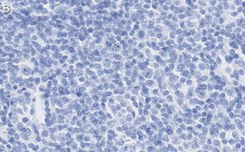 Anti-TNFβ/LTA Antibody, clone 3B20-H2 ZooMAb® Rabbit Monoclonal recombinant, expressed in HEK 293 cells