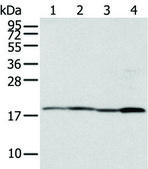 Anti-TIMM17A affinity isolated antibody