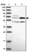 Anti-TBC1D19 antibody produced in rabbit Prestige Antibodies® Powered by Atlas Antibodies, affinity isolated antibody, buffered aqueous glycerol solution