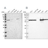 Anti-ACADVL antibody produced in rabbit Prestige Antibodies® Powered by Atlas Antibodies, affinity isolated antibody, buffered aqueous glycerol solution, Ab2