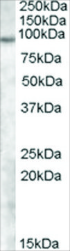 Anti-TCHHL1 antibody produced in goat affinity isolated antibody, buffered aqueous solution