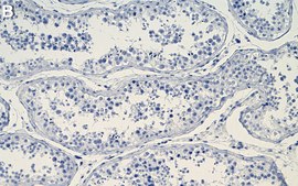 Anti-TRIP12 Antibody, clone 2H6 ZooMAb® Rabbit Monoclonal recombinant, expressed in HEK 293 cells