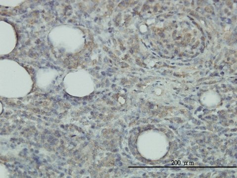 Monoclonal Anti-PRDX2 antibody produced in mouse clone 4E10-2D2, purified immunoglobulin, buffered aqueous solution