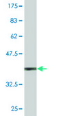 Monoclonal Anti-ORF1-FL49 antibody produced in mouse clone 4E11, purified immunoglobulin, buffered aqueous solution