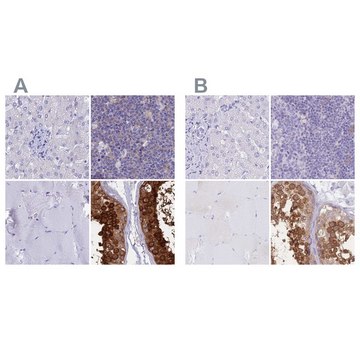 Anti-LZTFL1 antibody produced in rabbit Prestige Antibodies&#174; Powered by Atlas Antibodies, affinity isolated antibody, buffered aqueous glycerol solution