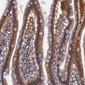 Anti-IGBP1 antibody produced in rabbit Ab1, Prestige Antibodies® Powered by Atlas Antibodies, affinity isolated antibody, buffered aqueous glycerol solution