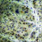 Anti-phospho-Calcium Sensing Receptor (pThr888) antibody produced in rabbit affinity isolated antibody