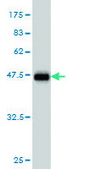 Monoclonal Anti-LMO2 antibody produced in mouse clone 6B8, purified immunoglobulin, buffered aqueous solution