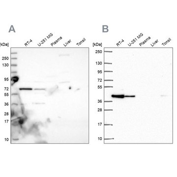 Anti-GIPC1 antibody produced in rabbit Prestige Antibodies&#174; Powered by Atlas Antibodies, affinity isolated antibody, buffered aqueous glycerol solution