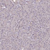Anti-CDC25B antibody produced in rabbit Prestige Antibodies® Powered by Atlas Antibodies, affinity isolated antibody, buffered aqueous glycerol solution