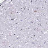 Anti-ST6GALNAC3 antibody produced in rabbit Prestige Antibodies® Powered by Atlas Antibodies, affinity isolated antibody, buffered aqueous glycerol solution