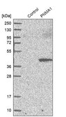 Anti-PNMA1 antibody produced in rabbit Ab1, Prestige Antibodies® Powered by Atlas Antibodies, affinity isolated antibody, buffered aqueous glycerol solution