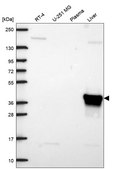 Anti-Aldob Antibody Produced In Rabbit Prestige Antibodies® Powered by Atlas Antibodies, affinity isolated antibody, buffered aqueous glycerol solution