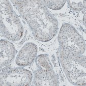 Anti-NOX4 antibody produced in rabbit Prestige Antibodies® Powered by Atlas Antibodies, affinity isolated antibody, buffered aqueous glycerol solution