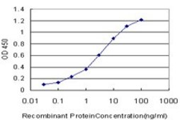 ANTI-OTX1 antibody produced in mouse clone 4E5, purified immunoglobulin, buffered aqueous solution