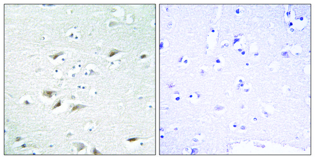 Anti-ZEB2 antibody produced in rabbit affinity isolated antibody