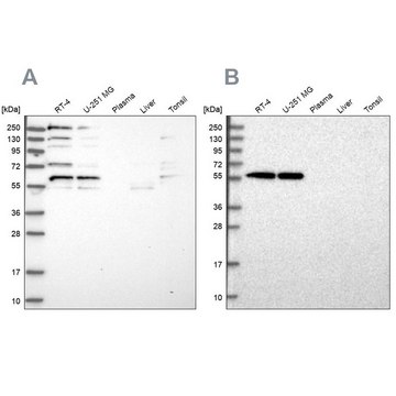 Anti-SAAL1 antibody produced in rabbit Prestige Antibodies&#174; Powered by Atlas Antibodies, affinity isolated antibody, buffered aqueous glycerol solution