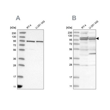 Anti-TBC1D5 antibody produced in rabbit Prestige Antibodies&#174; Powered by Atlas Antibodies, affinity isolated antibody, buffered aqueous glycerol solution