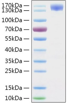 Recombinant 2019-nCoV Spike S1 Protein with hFc and His tag