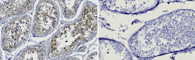 Anti-BubR1 Antibody, clone 1D23 ZooMAb&#174; Rabbit Monoclonal recombinant, expressed in HEK 293 cells