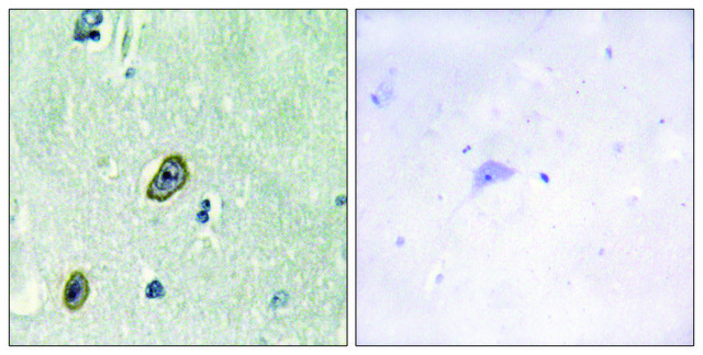 Anti-KCIP1 antibody produced in rabbit affinity isolated antibody