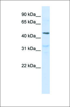 Anti-IL28RA antibody produced in rabbit affinity isolated antibody