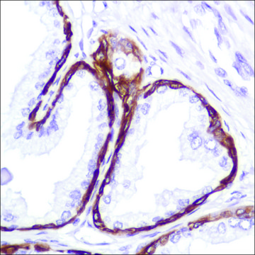 Anti-Keratin 5 antibody, Rabbit monoclonal recombinant, expressed in proprietary host, clone SP178, affinity isolated antibody