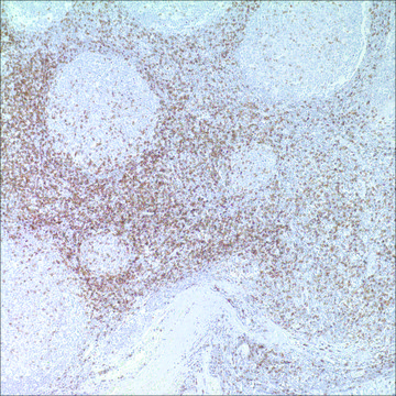 CD45RO (UCHL-1) Mouse Monoclonal Antibody